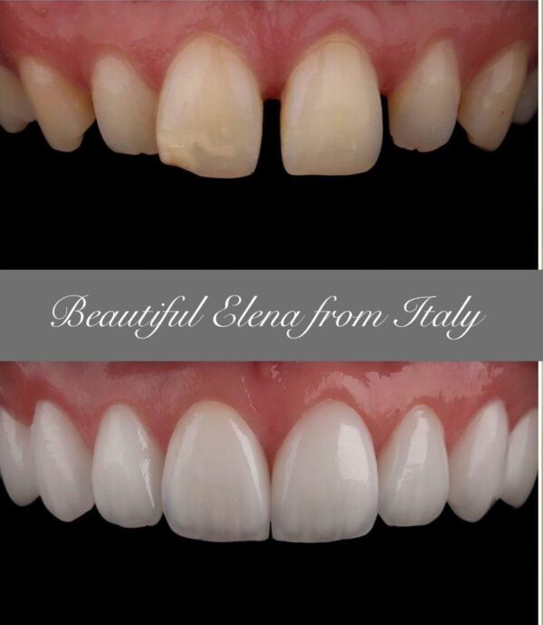 Hollywood Smile - Image 3