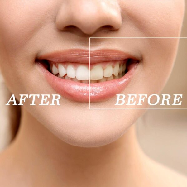 Cleaning and Whitening - Image 3