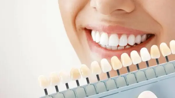 Cleaning and Whitening - Image 2