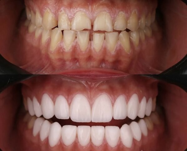 Hollywood Smile - Image 6
