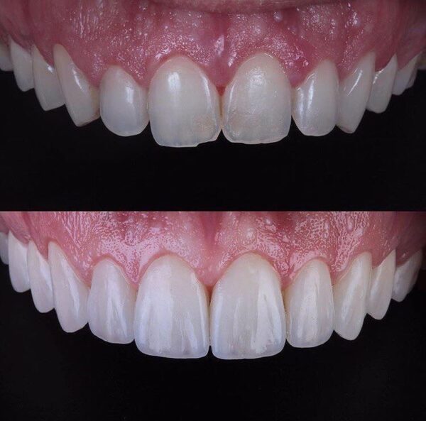 Hollywood Smile - Image 9