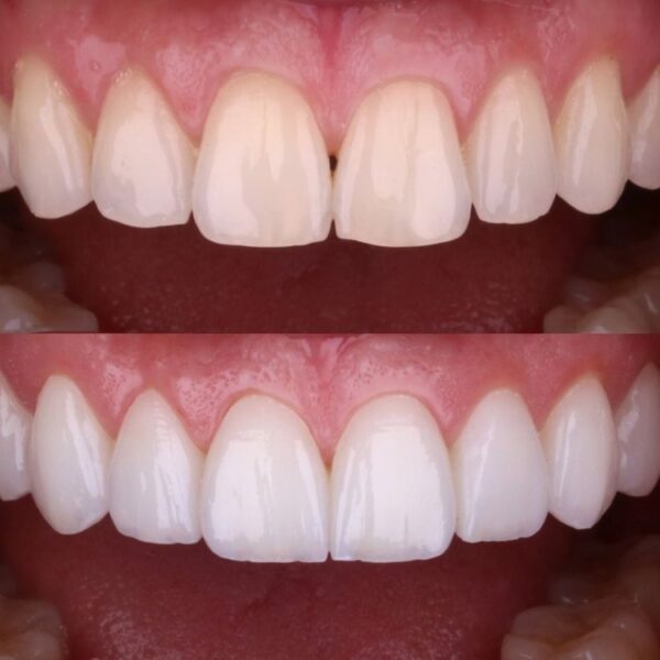 Cleaning and Whitening - Image 6