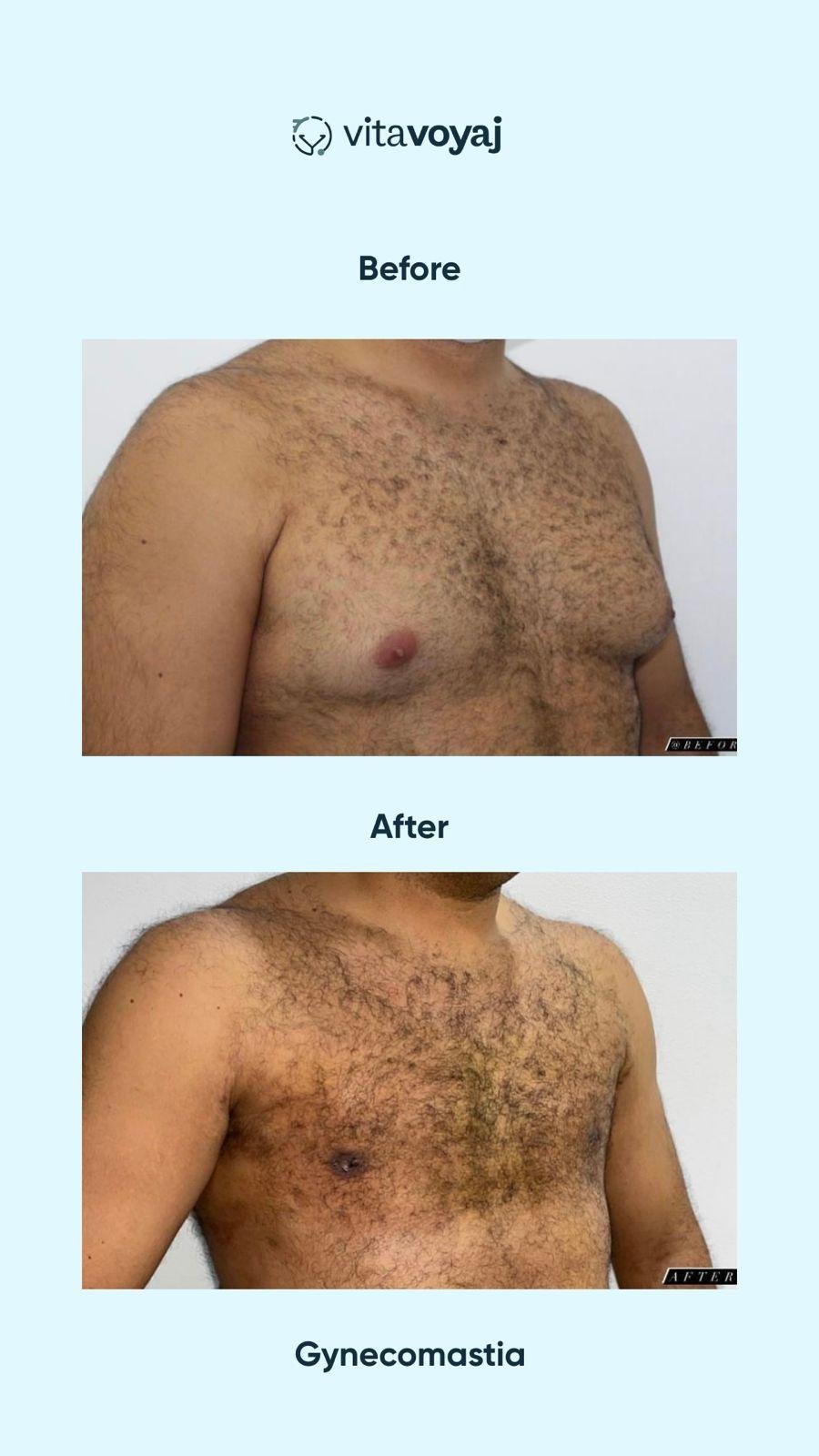 Plastic surgeries - Image 2