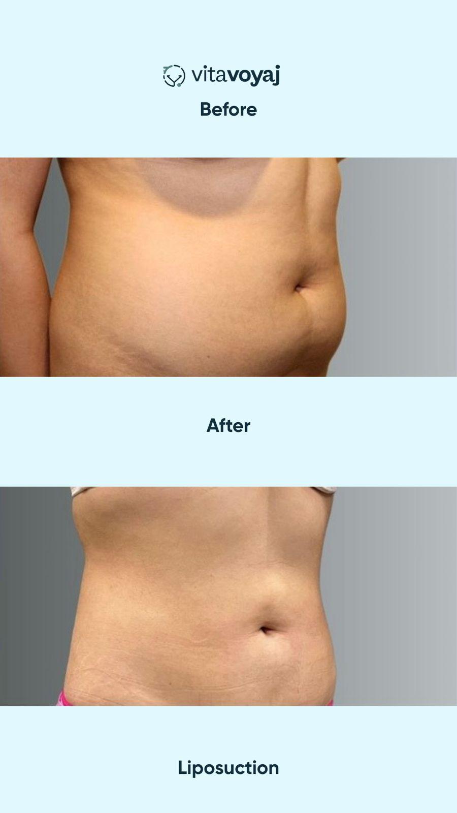 Plastic surgeries - Image 3
