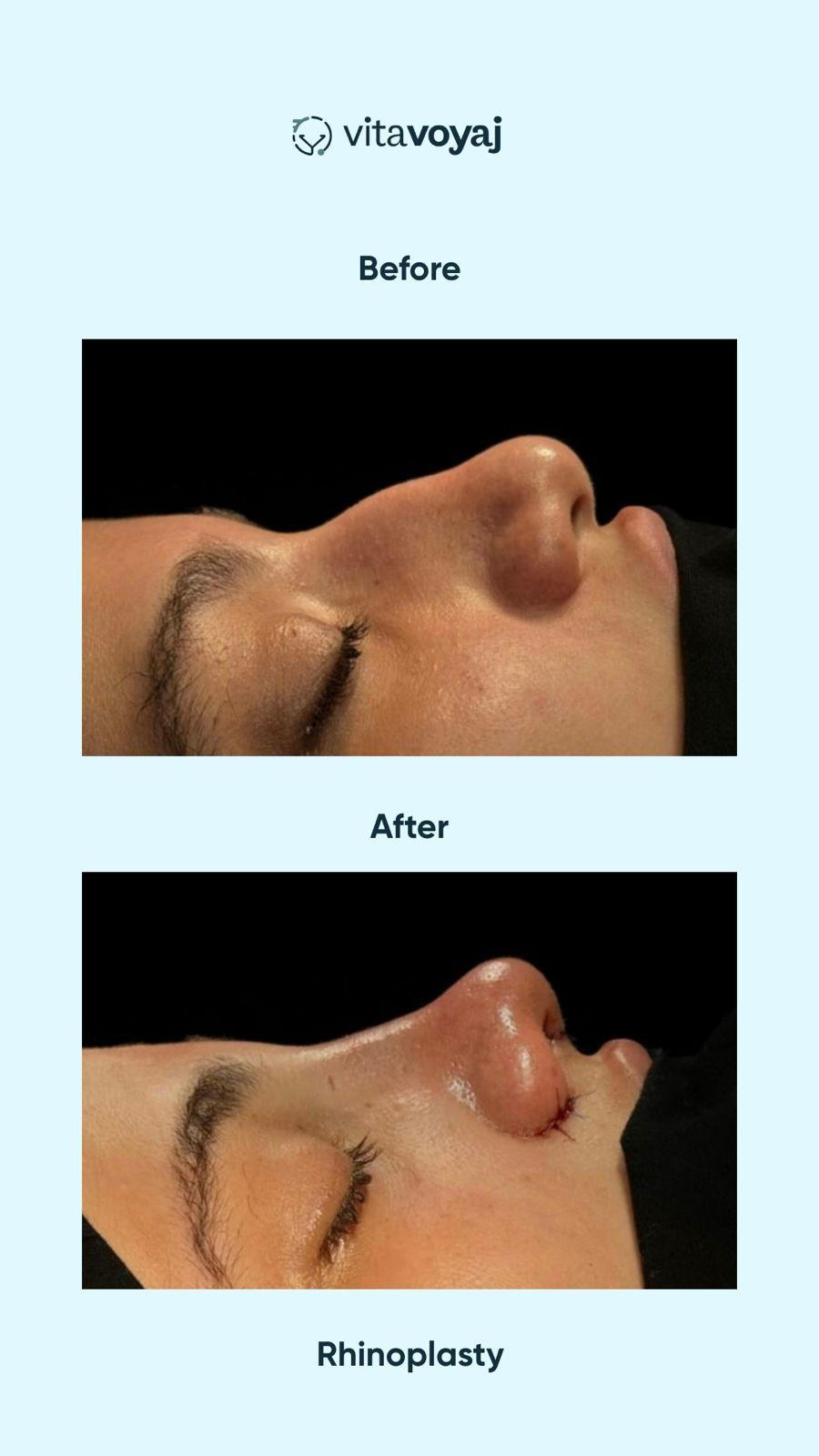 Plastic surgeries - Image 4