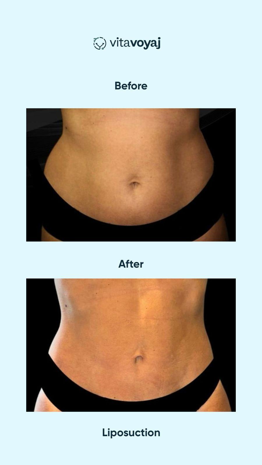 Plastic surgeries - Image 5