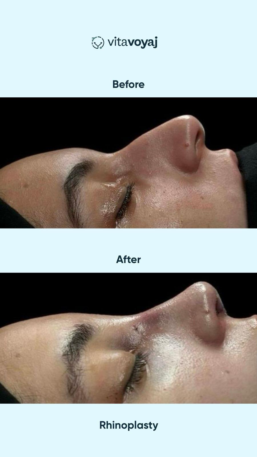 Plastic surgeries - Image 6