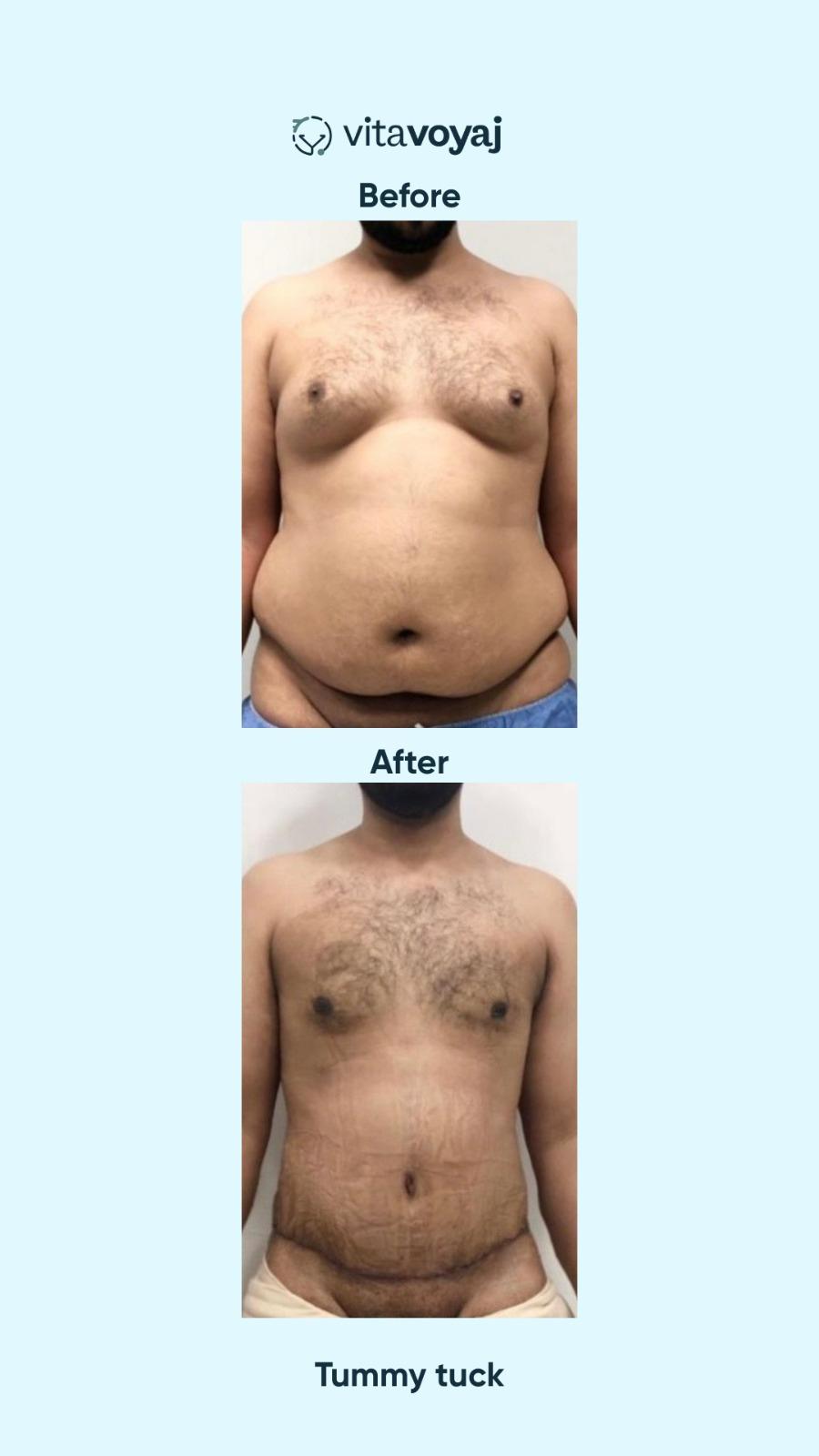 Plastic surgeries - Image 7