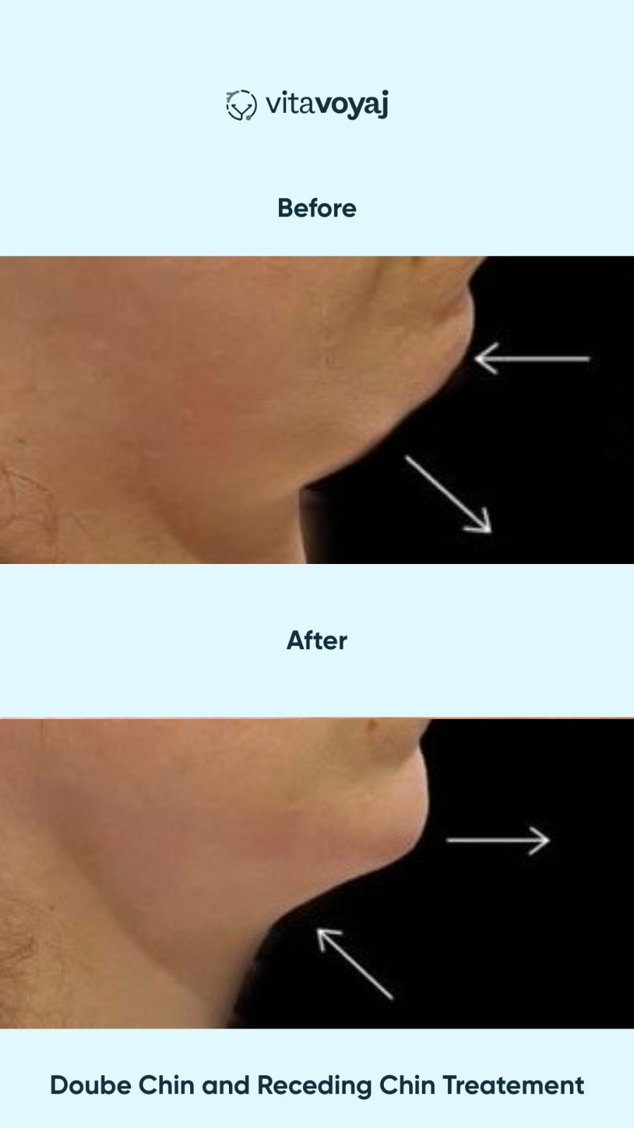 Plastic surgeries - Image 8