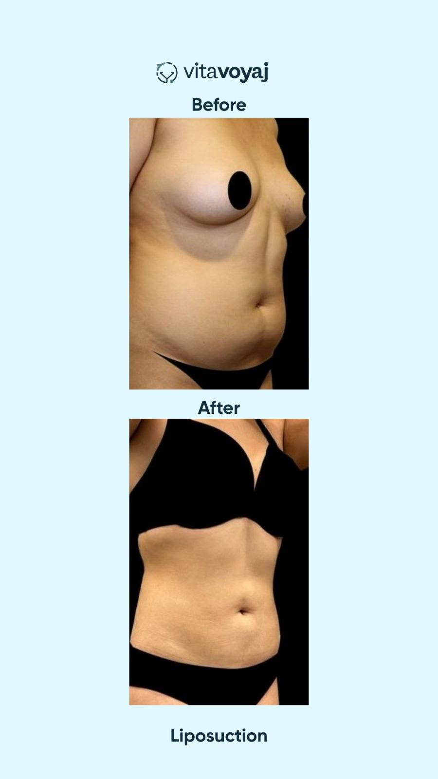 Plastic surgeries - Image 9
