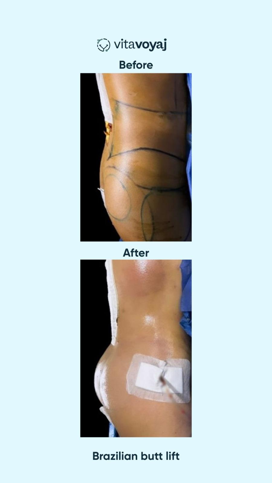 Plastic surgeries - Image 10