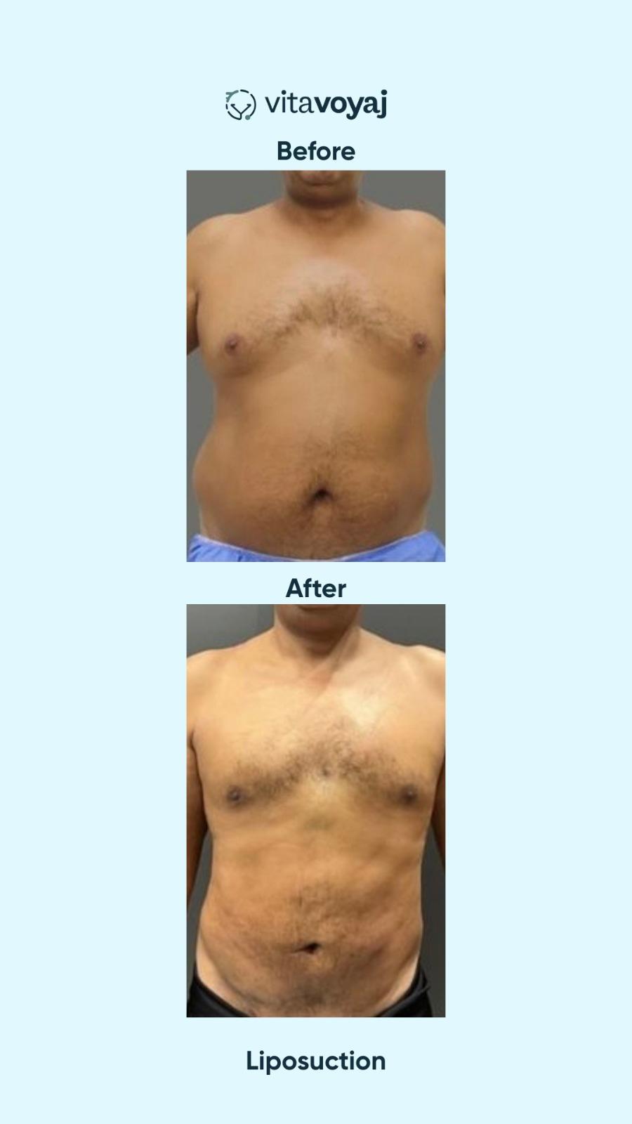 Plastic surgeries - Image 11