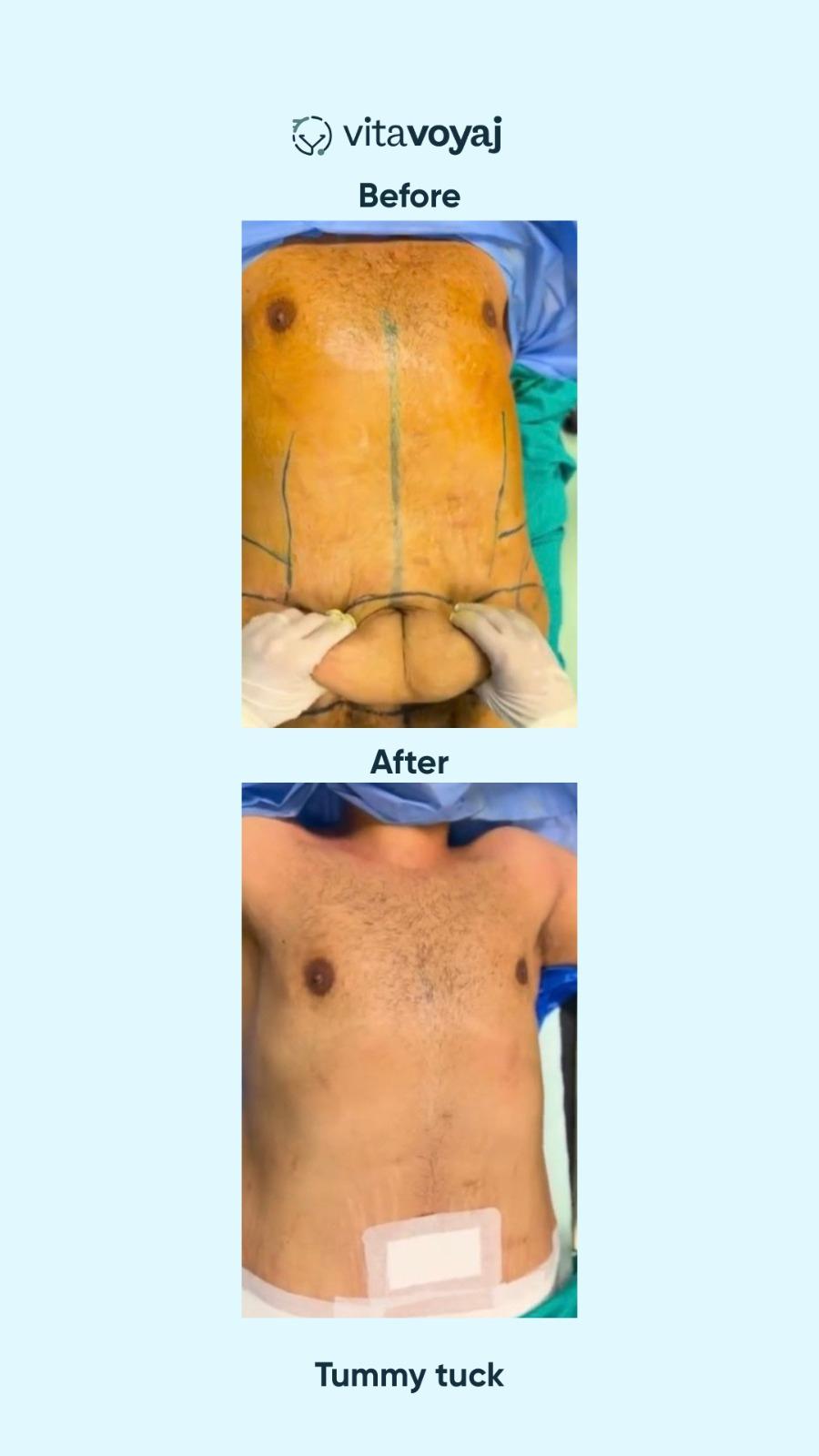 Plastic surgeries - Image 12