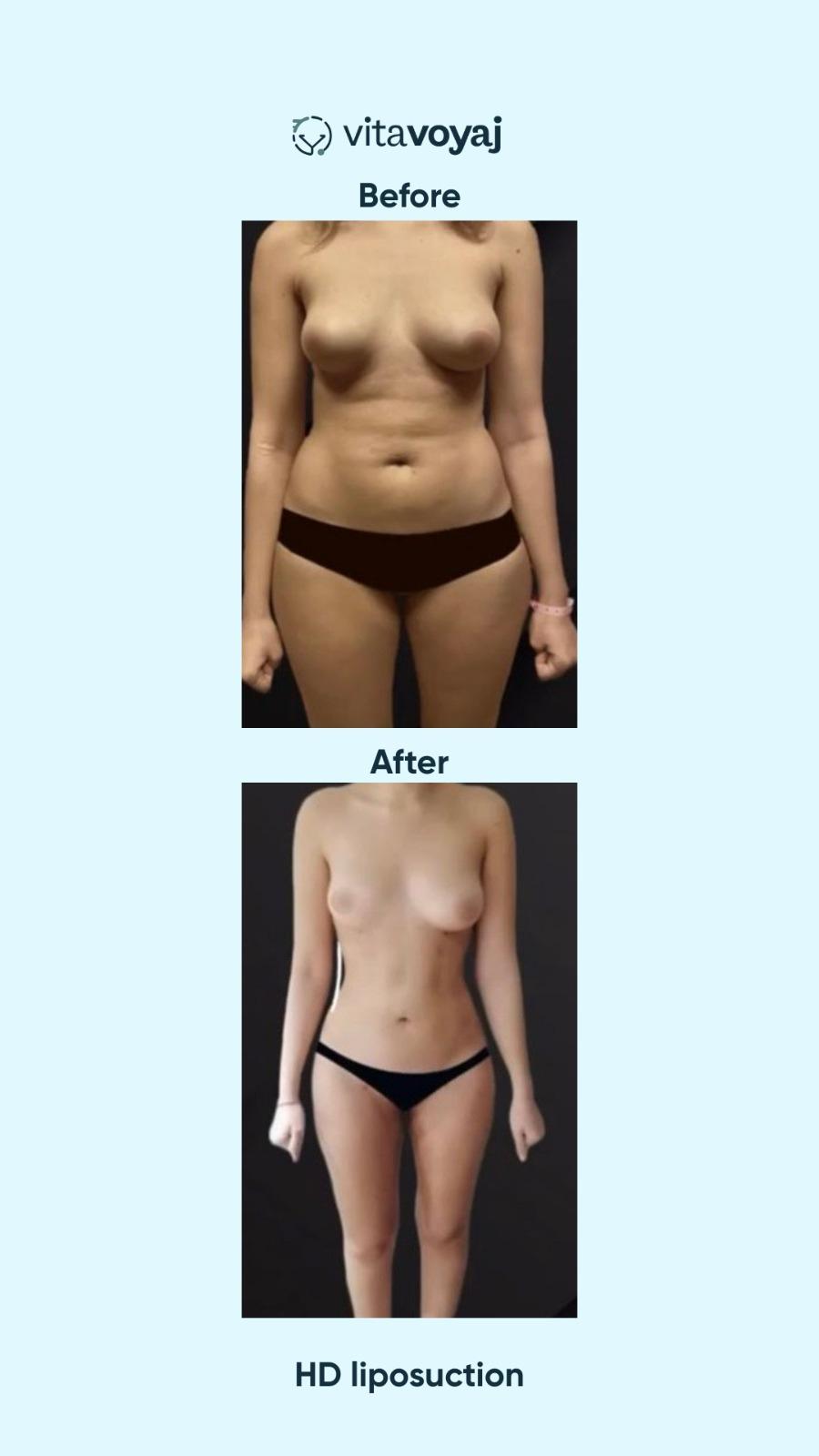 Plastic surgeries - Image 14