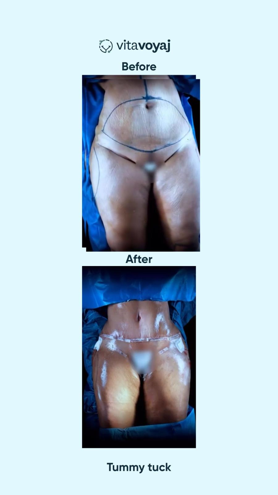 Plastic surgeries - Image 15