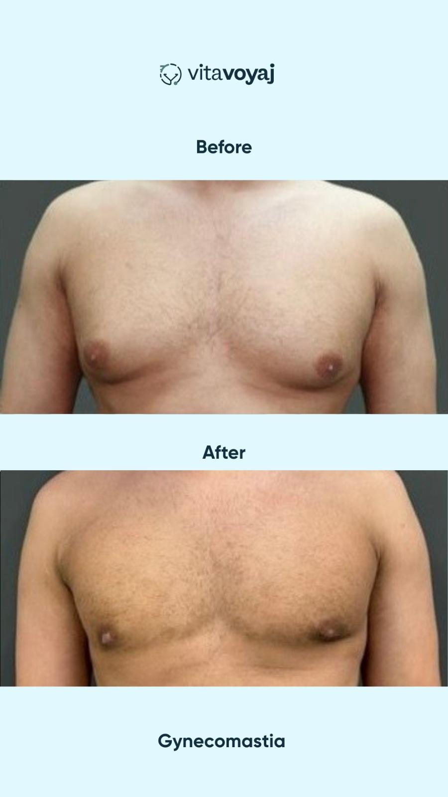 Plastic surgeries - Image 16