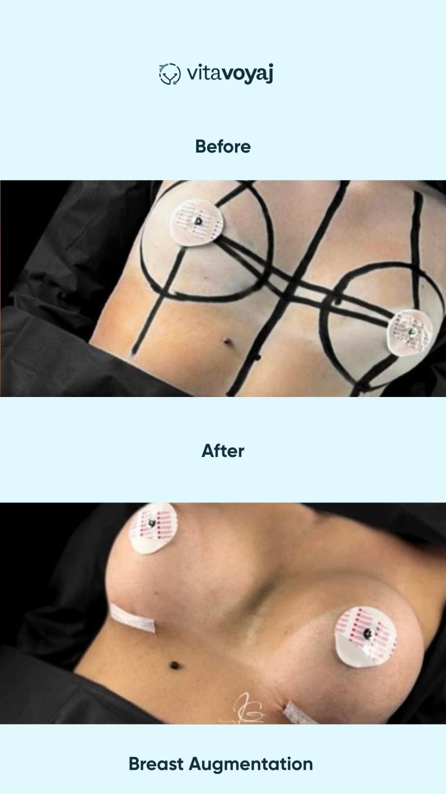 Plastic surgeries - Image 18