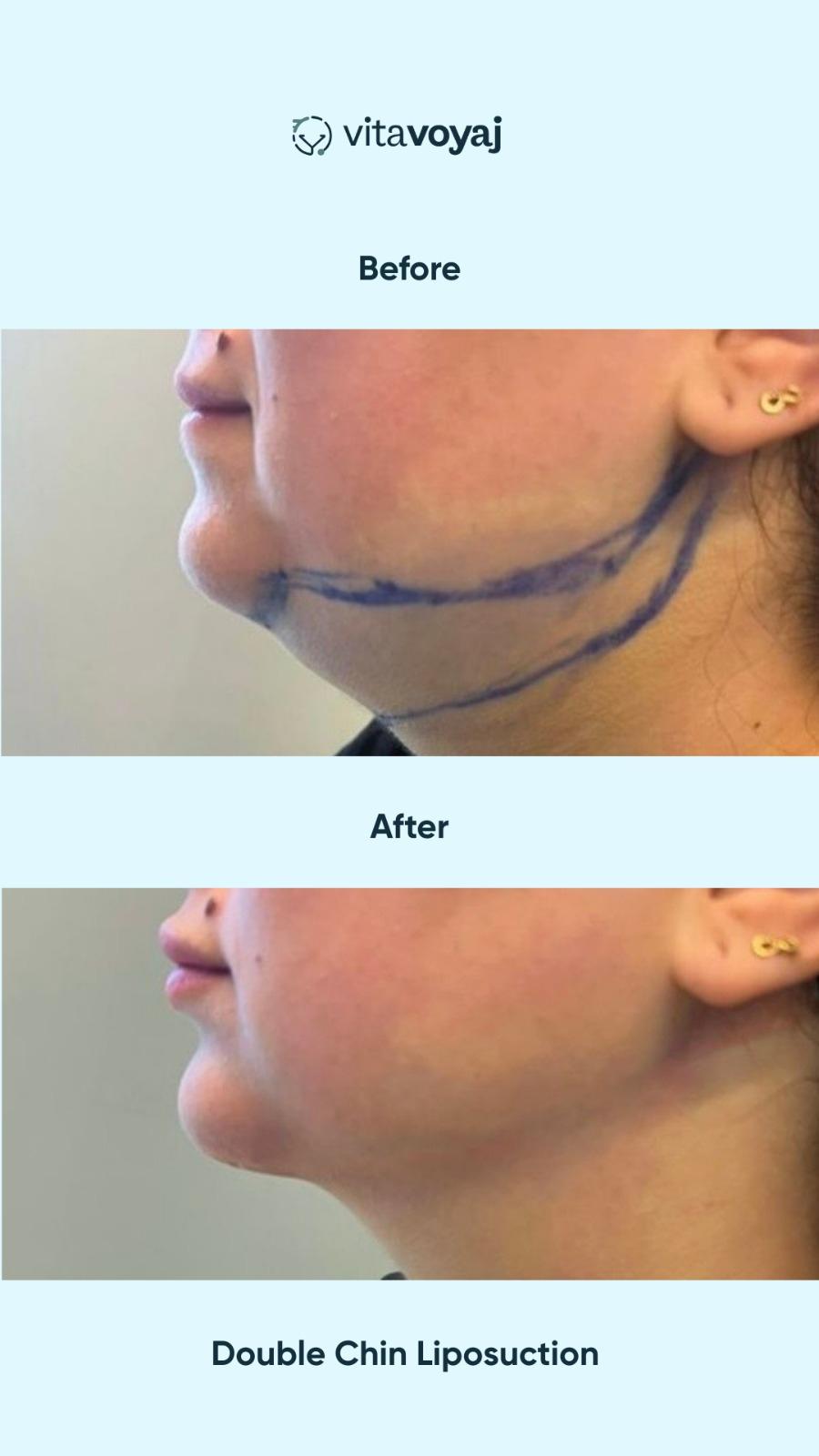 Plastic surgeries - Image 19