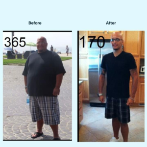 Revisional Bariatric Surgery