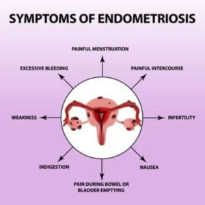 laproscopic Endometriosis